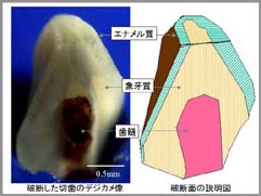 破断した歯の構造説明図１