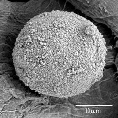 図１　ヒノキの花粉