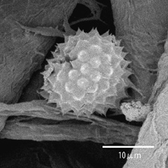 図4　ブタクサの花粉